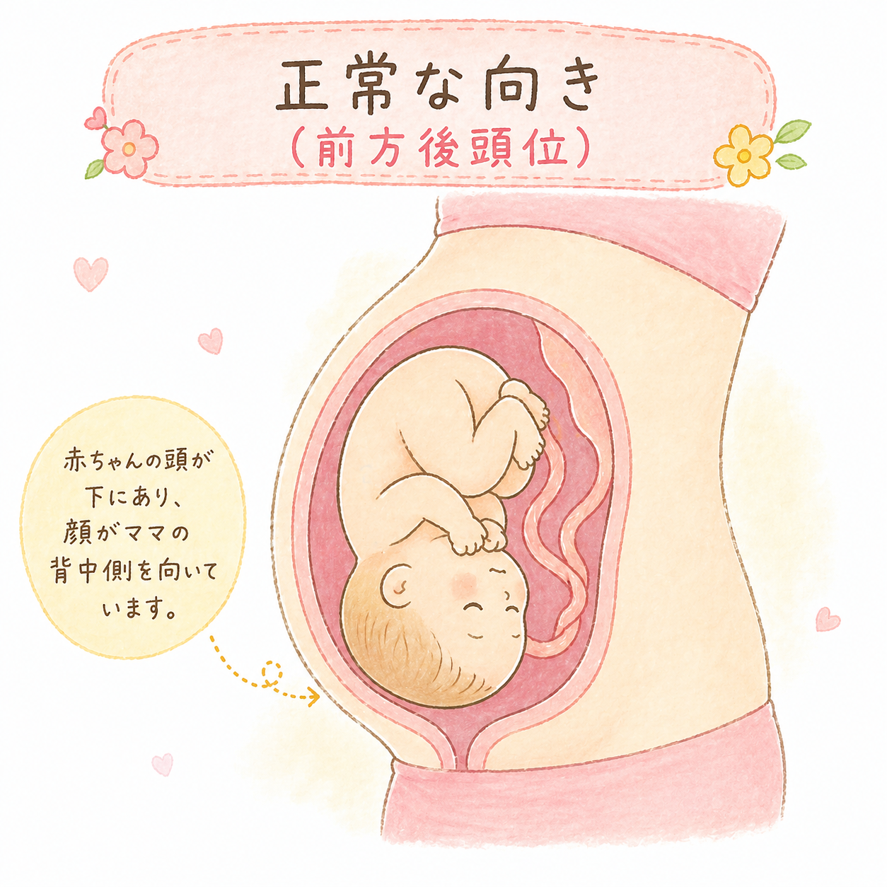 正常な向き（前方後頭位）